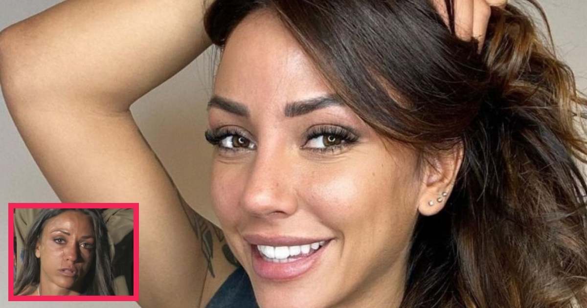selvaggia roma prima e dopo