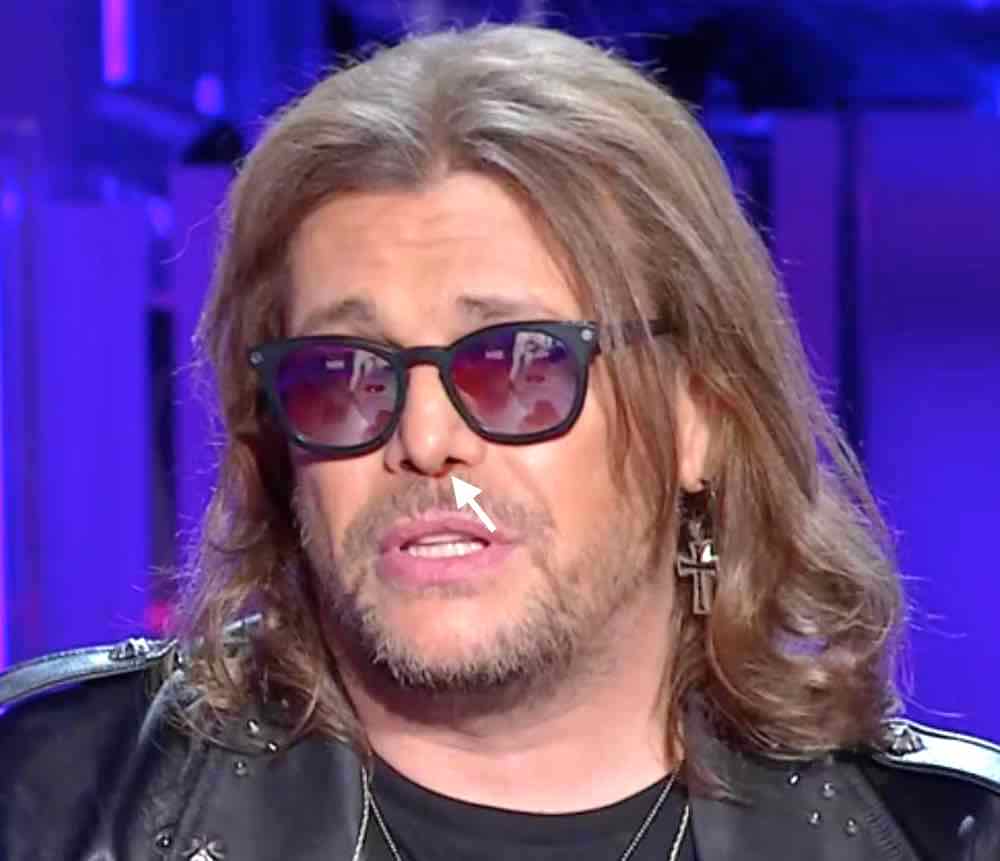gianluca perde sangue