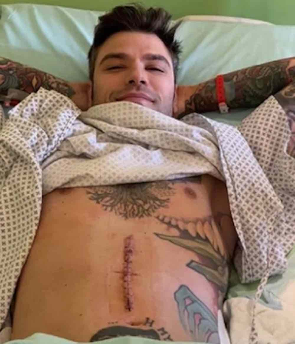 Fedez torna sotto ferri