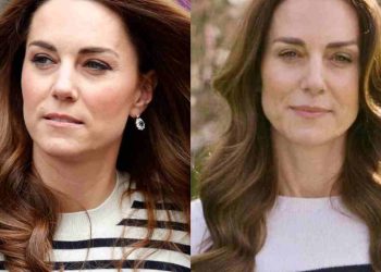 Kate Middleton, spunta la coincidenza sulla malattia che fa venire la pelle d’oca