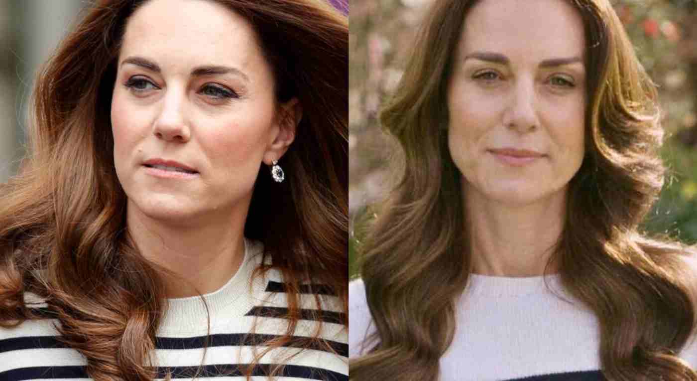 Kate Middleton, spunta la coincidenza sulla malattia che fa venire la pelle d'oca: cos'è successo