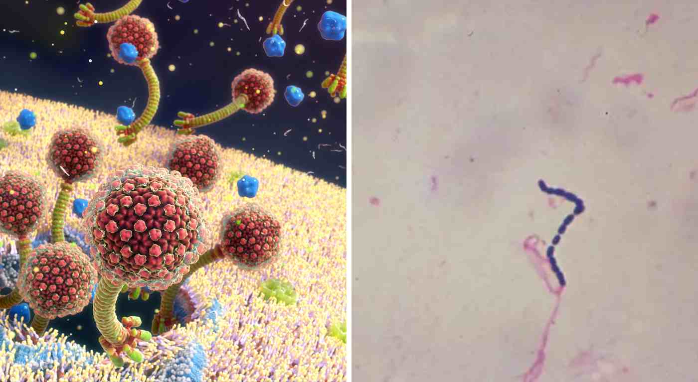 Batterio "carnivoro", panico in tutto il mondo: quali sono i sintomi, contagio e le possibili cure