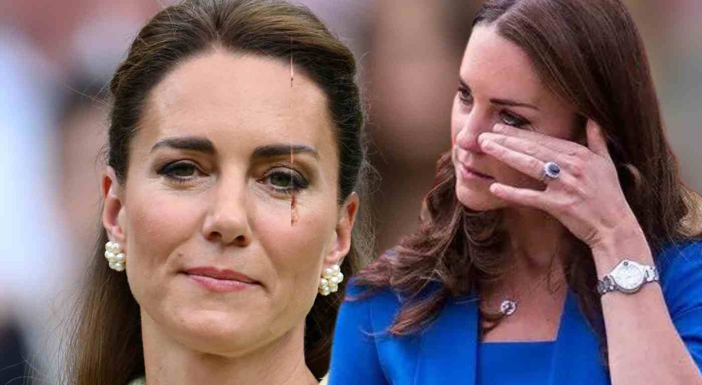Kate Middleton, lo zio rompe il silenzio e fa una dichiarazione: "So come sta davvero"