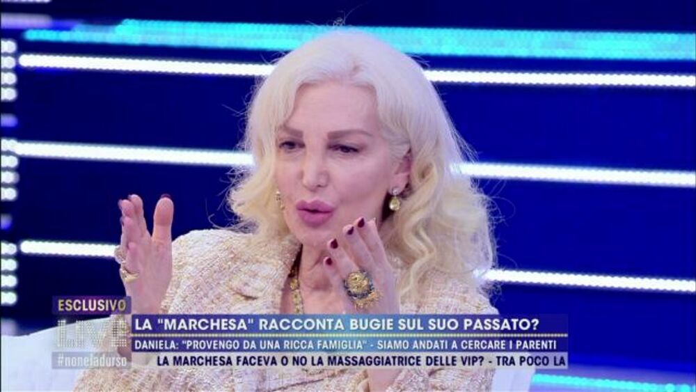 "Volete vedere il mio faccino nuovo?". La Marchesa d'Aragona si presenta dopo il lifting al viso - FOTO