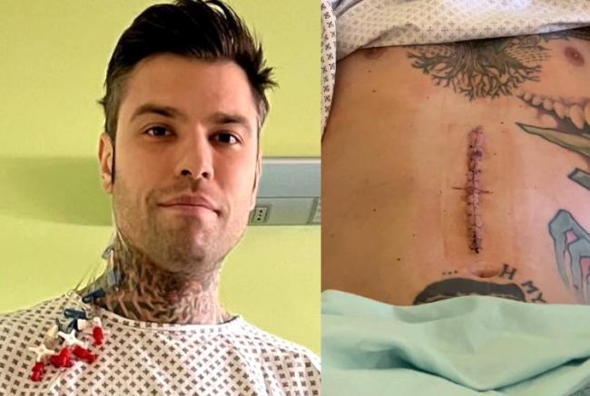 Fedez colto da malore improvviso: ecco perché ha dovuto abbandonare Cattelan all'ultimo minuto