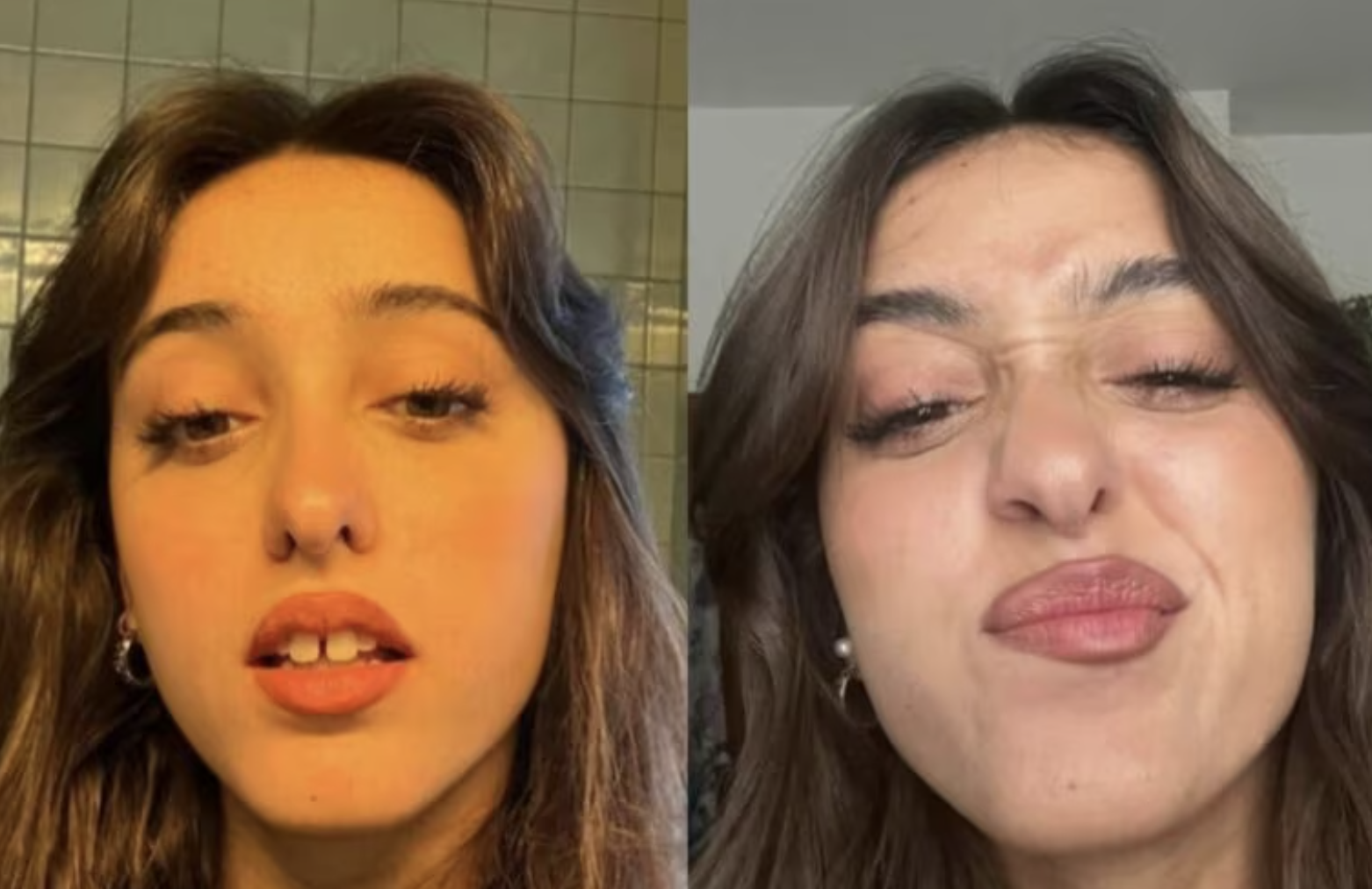 Giulia Stabile, attacco feroce: "Non hai i soldi per il dentista?". Lei gela tutti